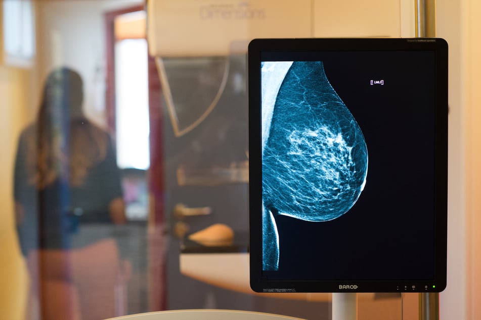 Die Brust einer Frau wird im Rahmen einer Mammografie geröntgt. Mit diesem Verfahren kann Brustkrebs (frühzeitig) erkannt werden.