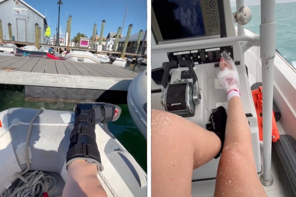 Heather West filmed her injured foot and the two-hour trip to the hospital.