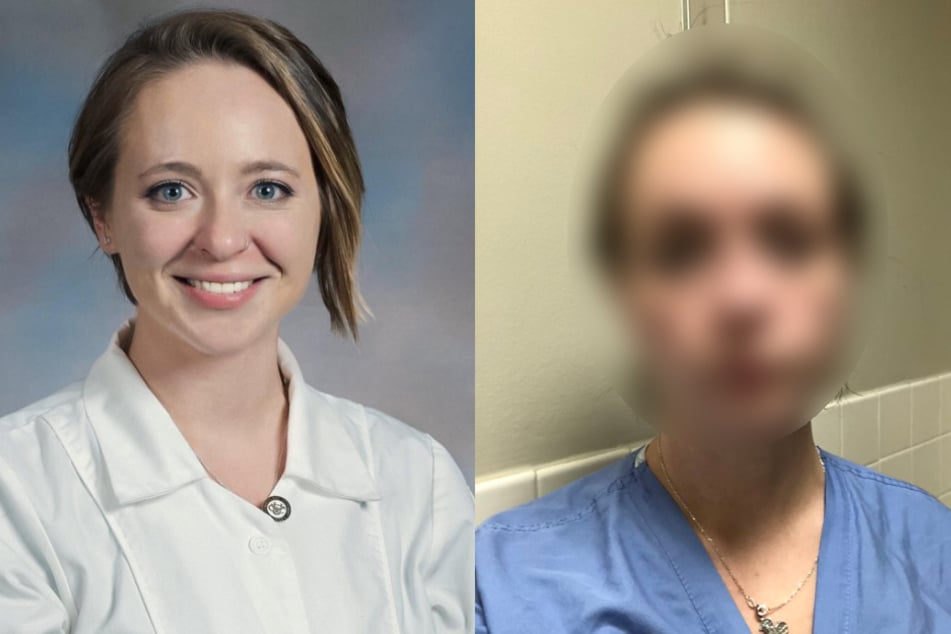 Krasser Vorher-Nachher-Vergleich: Krankenschwester zeigt, was Arbeit mit ihr gemacht hat