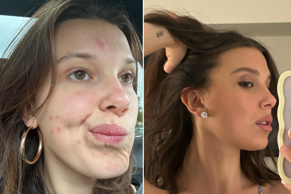 Millie Bobby Brown revealed her makeup-free skin in a new selfie promoting her beauty brand.