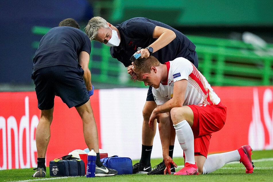 Linksverteidiger Marcel Halstenberg (28) hatte sich im Luftduell gegen Stefan Savic (28) ebenso wie sein Gegenspieler einen Cut zugezogen.