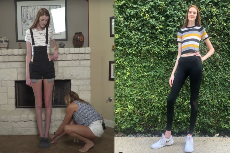 Legs for days: Texas girl breaks record for longest limbs