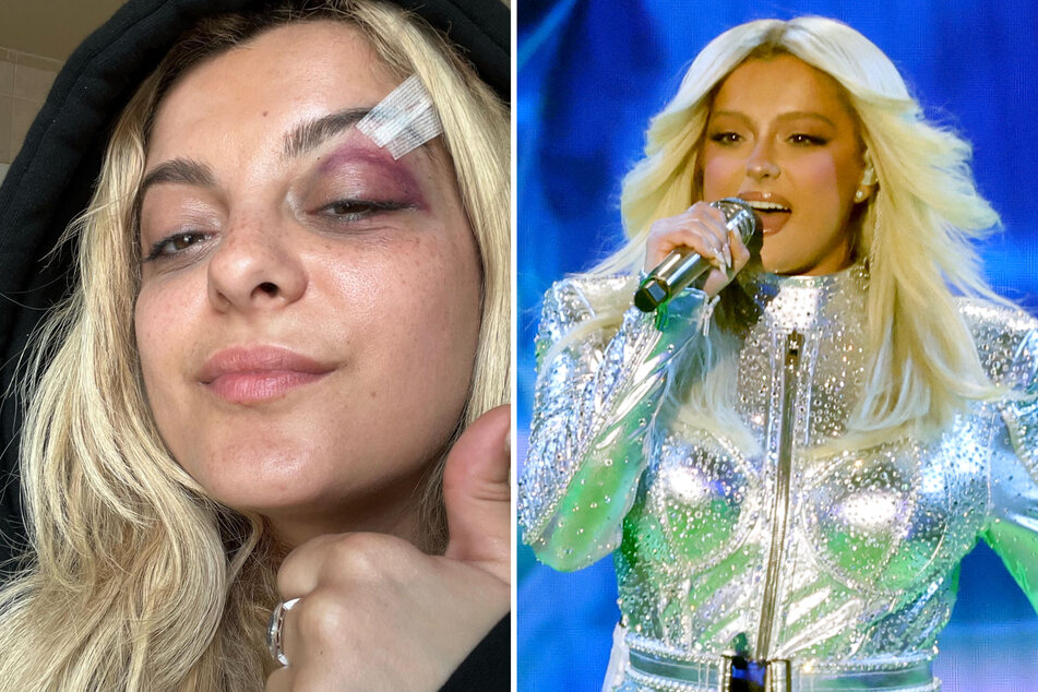 Bebe Rexha was hit by a cell phone thrown by a fan during her concert in New York on Sunday.