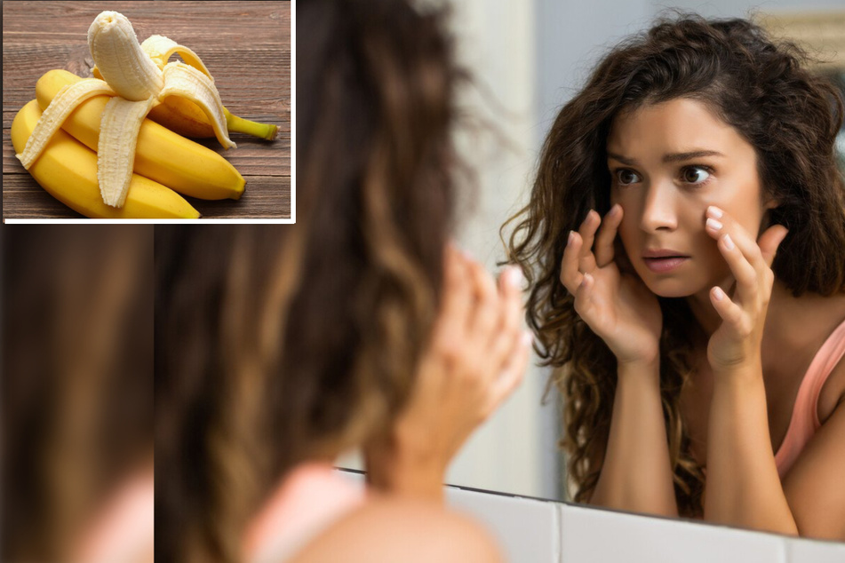 Banana TikTok trend: Does the beauty hack really kick dark under eye circles?