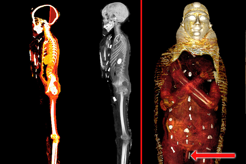 Forscher blicken zum ersten Mal in 2300 Jahre alte Mumie: Das fand man neben dem Penis des Toten