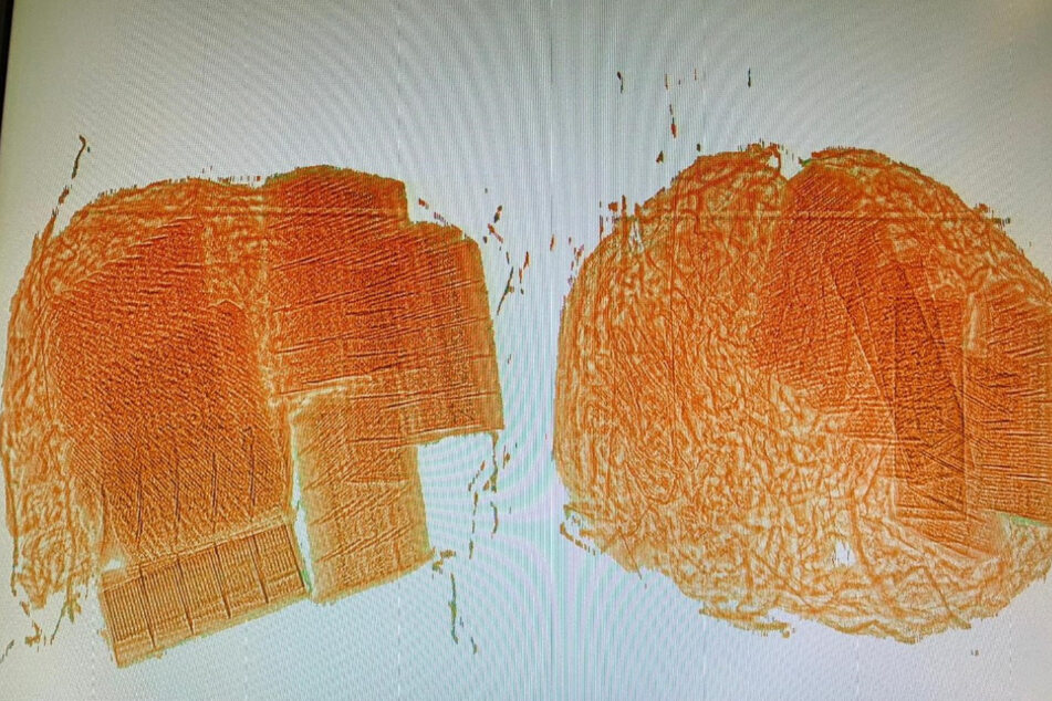 Ein Röntgenbild der versteckten Zigaretten.