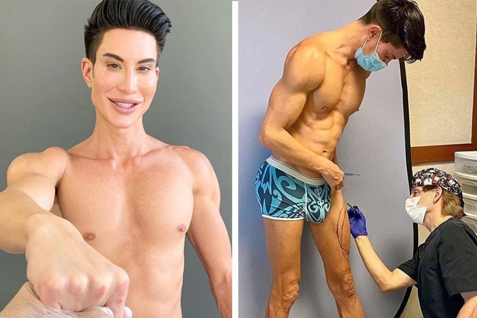 Human Ken Doll Justin Jedlica has spent nearly $1 million transforming his body.