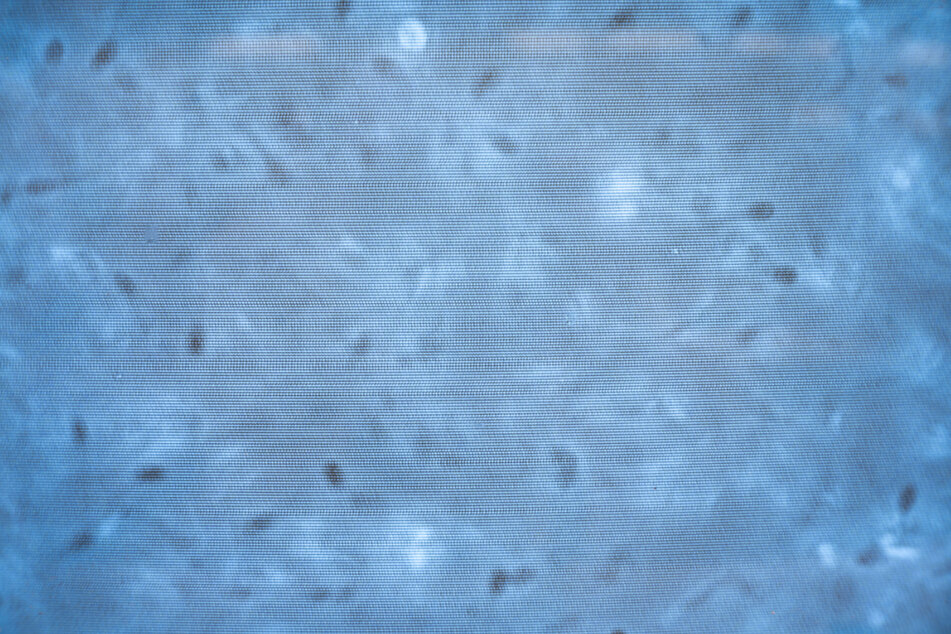 Eber-Ejakulat unterm Mikroskop.