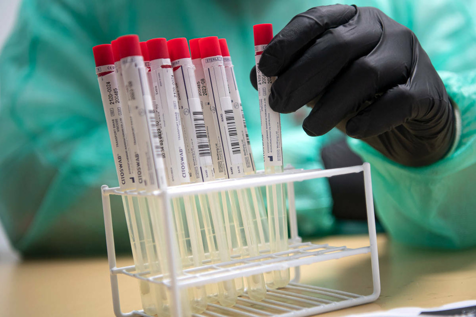 Proben für einen PCR-Test werden von einem Mitarbeiter im Corona-Testzentrum sortiert. In Berlin sind am Montag mehr Corona-Neuinfektionen gemeldet worden als vor Wochenfrist. (Symbolfoto)