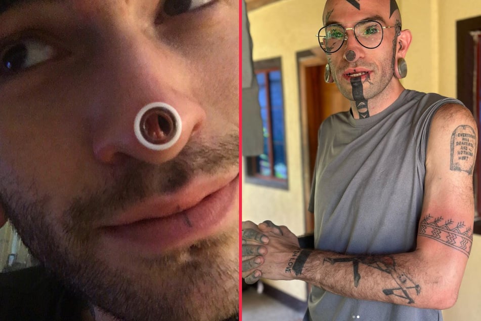 Tattoo and body mod addict wants to remove belly button