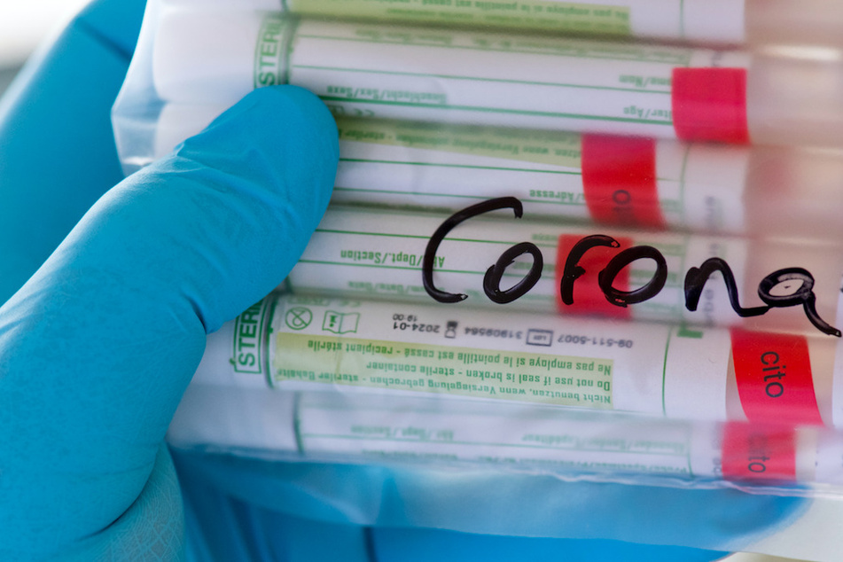 Proben für Corona-Tests werden in einem Labor für die weitere Untersuchung vorbereitet.