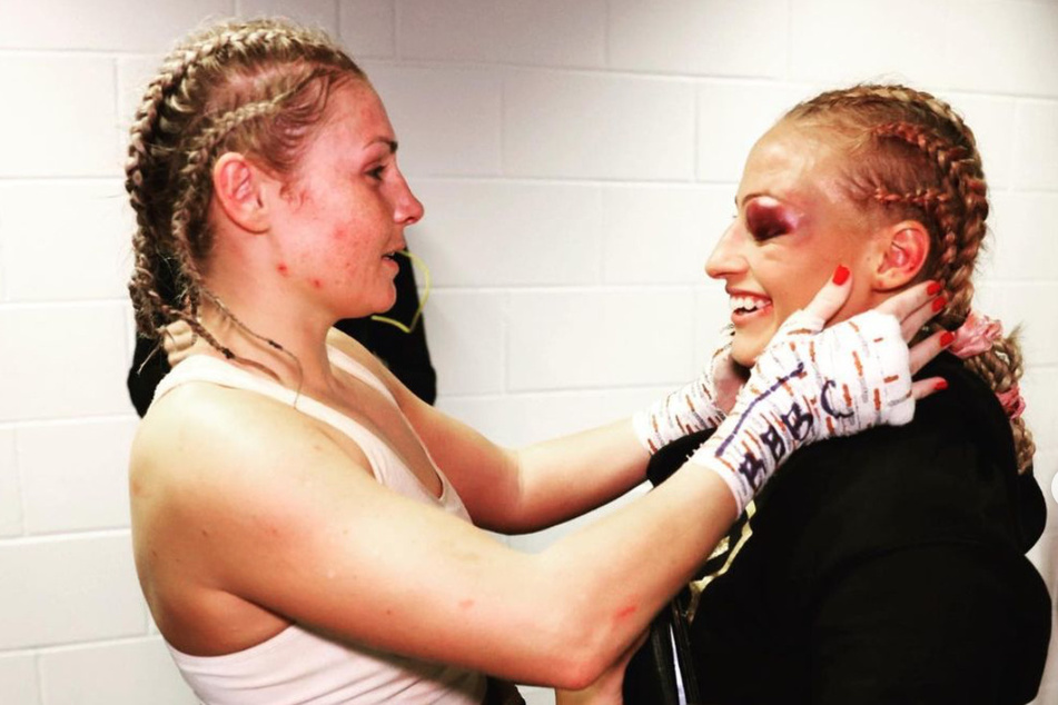 Shannon Courtenay checks out the black eye she gave Ebanie Bridges after the fight last Saturday. The two left the ring with increased respect for one another.