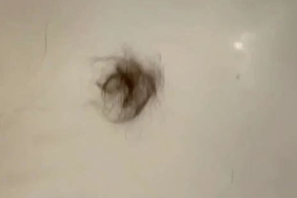 In ihrer Duschkabine fand Mia plötzlich braune Haarbüschel.