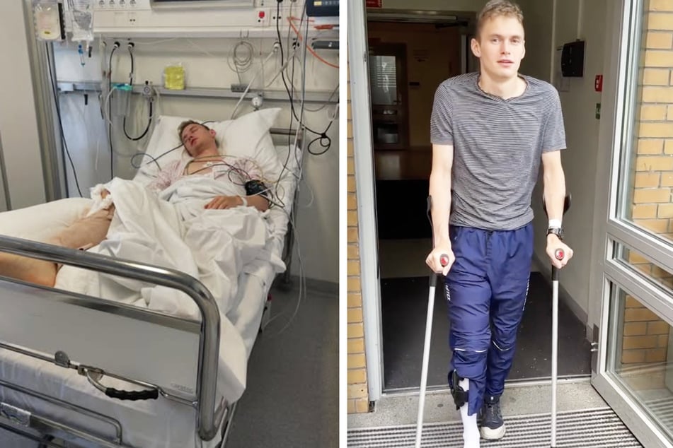 Oskar Strømer (29) wurde inzwischen erfolgreich operiert.