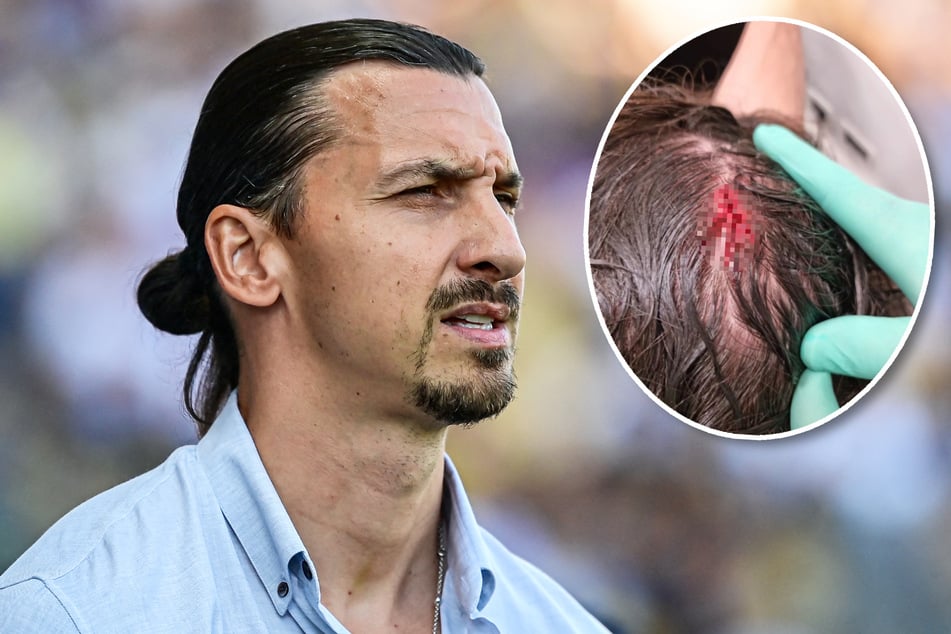 "Triggerwarnung": Zlatan Ibrahimovic schockt Fans mit heftiger Kopfwunde