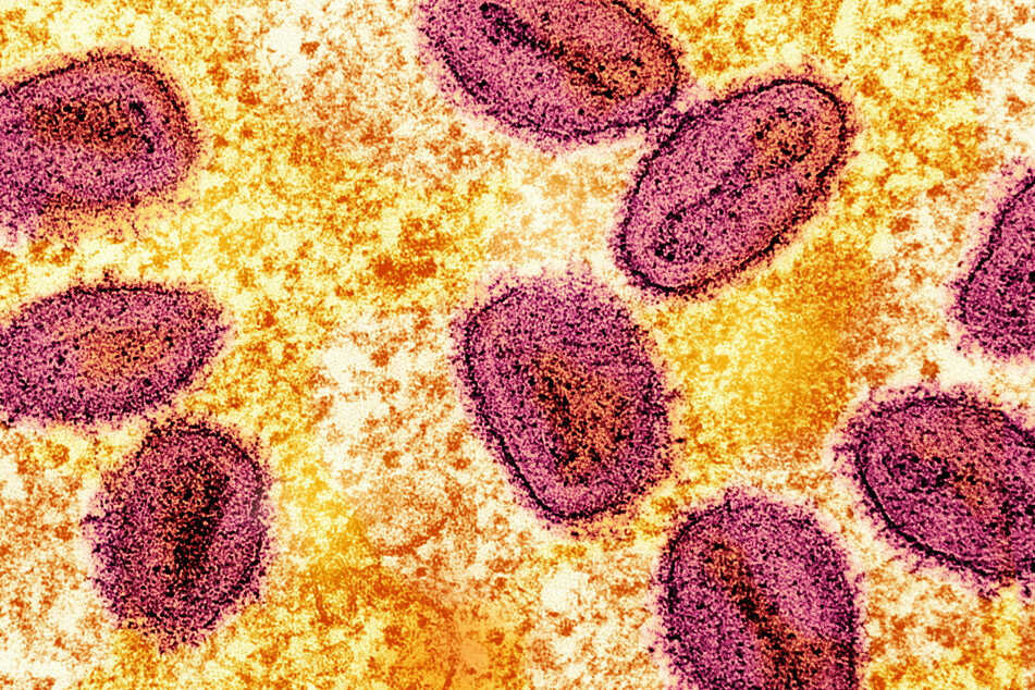 The California Department of Public Health confirmed the first case of a person infected with the new clade I strain of mpox.