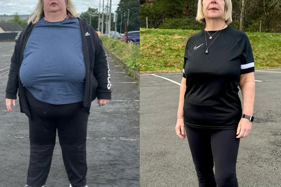 Karen H. lost 207 Ibs with Simple