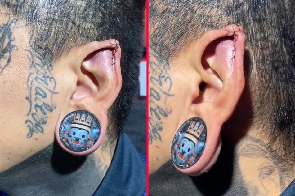 A tattooed man got the top of his ear snipped and then restitched together to make him look more like an elf.