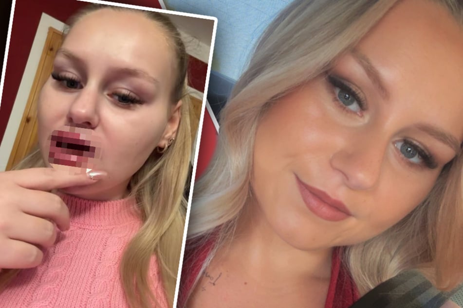 Sarah-Jane Wollny kann sich nach Lippenaufspritzung "selbst nicht ernst nehmen"