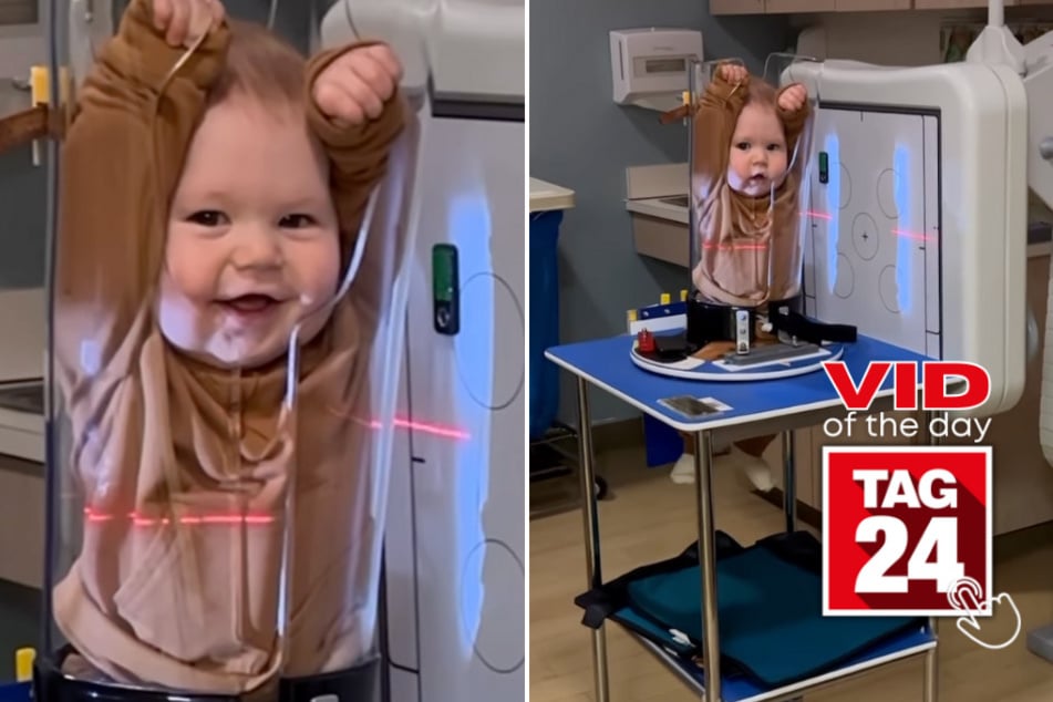 viral videos: Viral Video of the Day for January 31, 2024: This baby can't stop smiling – even during an X-ray!