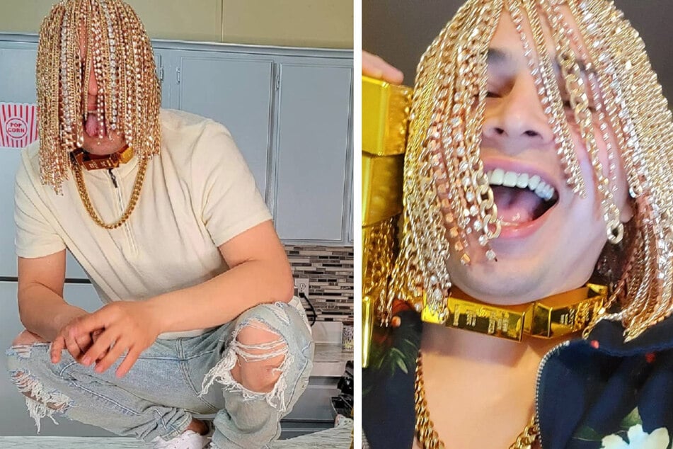 Dieser Rapper hat sich mehrere Goldketten in seine Kopfhaut implantieren lassen