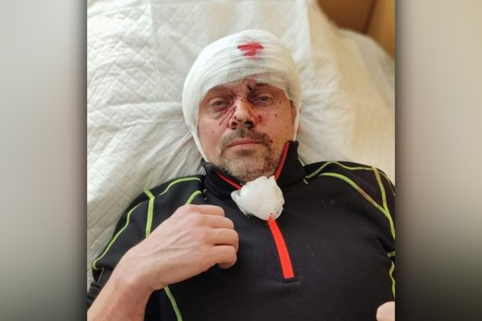 Steve Meiling (42) ist auf dem Weg zu seiner Frau Anna (33) in der Ukraine angeschossen worden.
