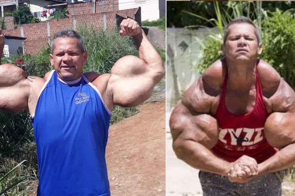 Der Gewichtheber galt als brasilianischer Popeye und besaß einen Bizeps mit einem Umfang von 74 Zentimetern.