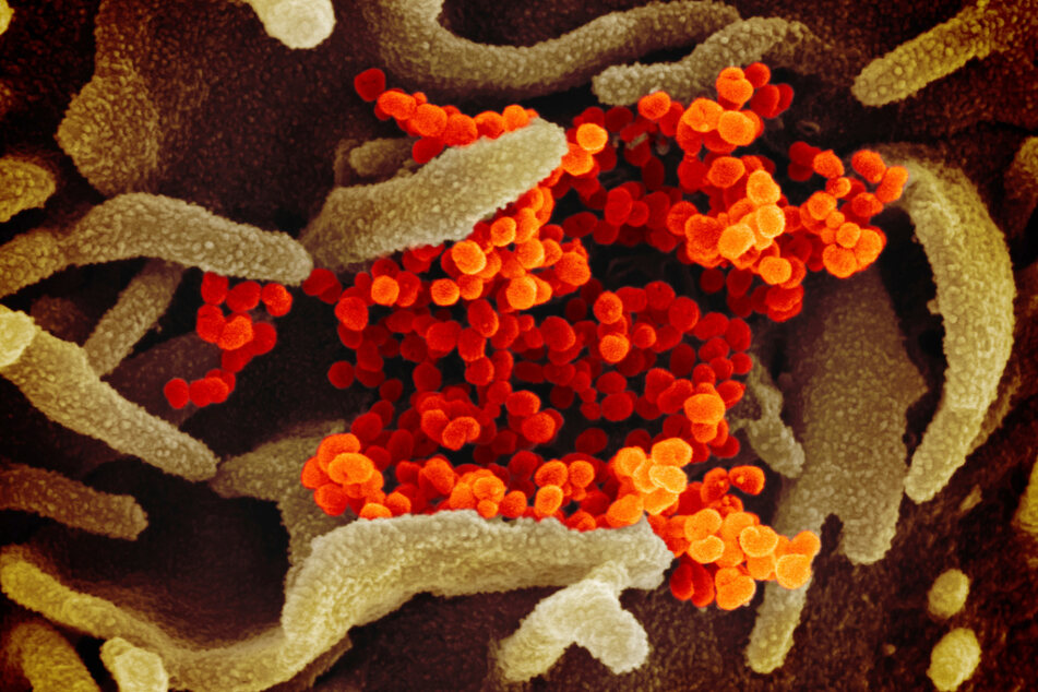 Eine elektronenmikroskopische Aufnahme des Coronavirus. In Jena ist erstmals die Delta-Variante des neuartigen Erregers nachgewiesen worden. (Symbolbild)