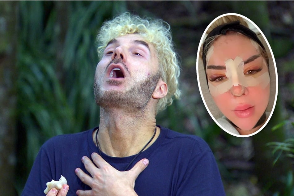 "Ich dachte, das ist KI!": Reality-Star schockiert von Emma Fernlunds Dreifach-OP