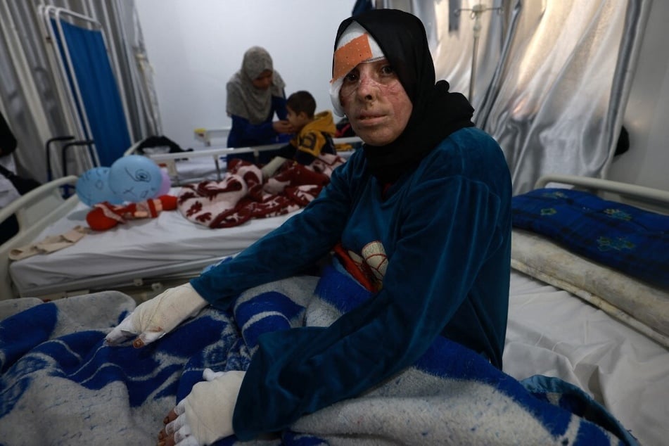 Palestinian Nisrine al-Najar receives treatment for severe injuries and burns sustained during Israeli bombardment at a clinic set up by Doctors Without Border inside the Rafah Indonesian Field Hospital in the southern Gaza Strip.