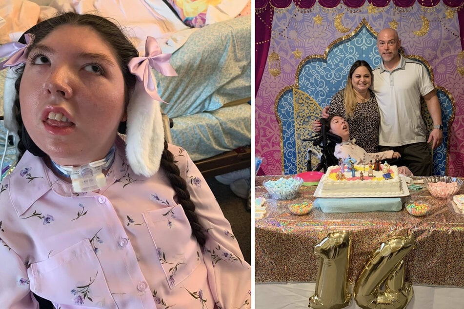 Alex Simpson, de Nebraska, lleva casi 20 años viviendo casi sin cerebro.