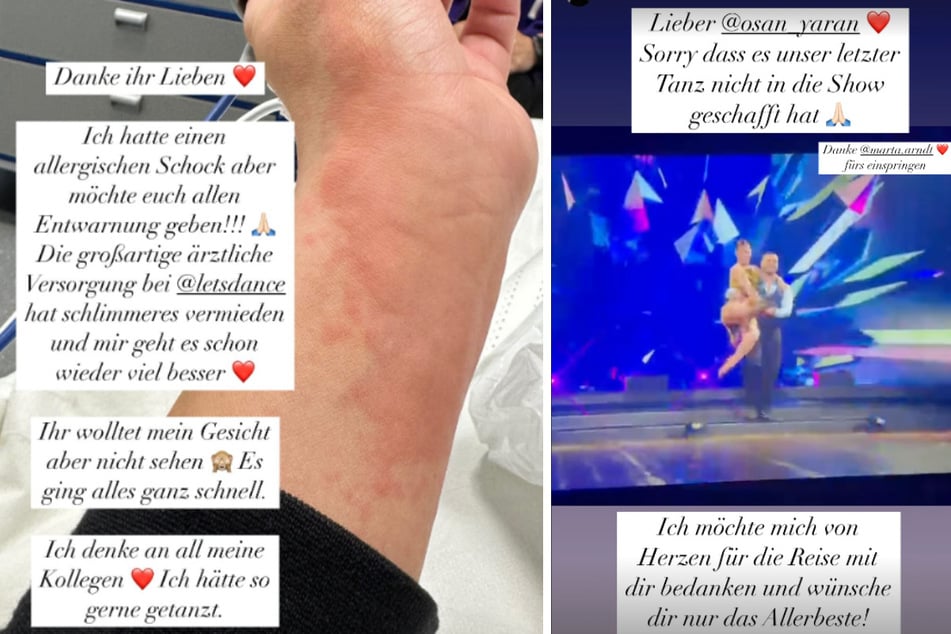 Ein allergischer Schock kurz vor Beginn der Show machte Christinas Final-Auftritt einen Strich durch die Rechnung.