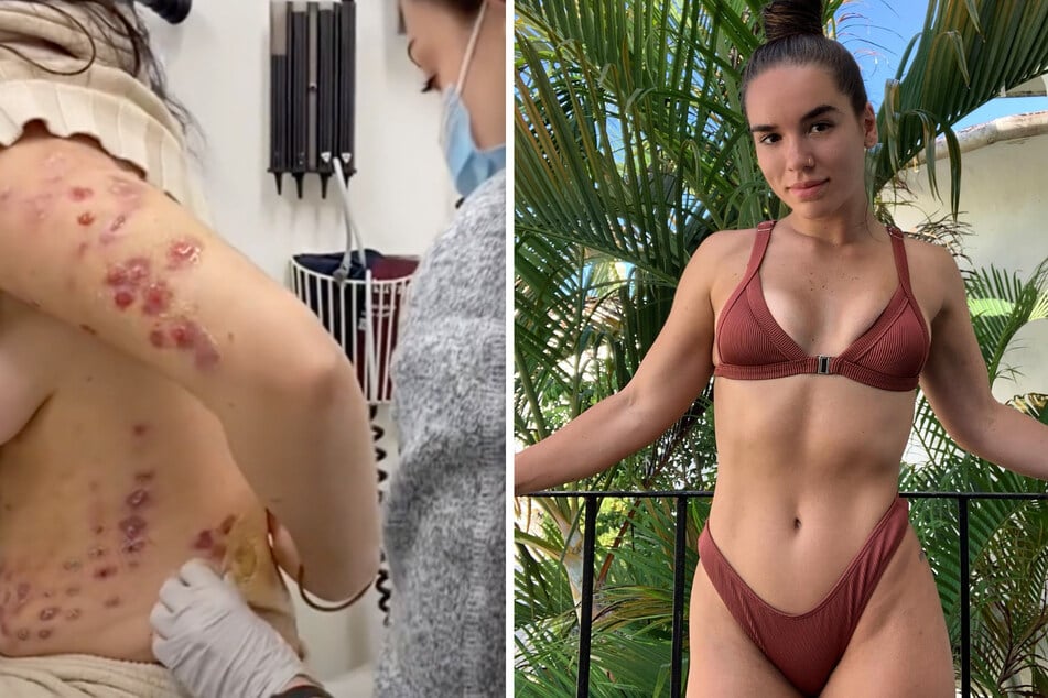 Fitness-Model (26) nach verpfuschtem Beauty-Eingriff völlig entstellt: Fake-Arzt lacht sie auch noch aus