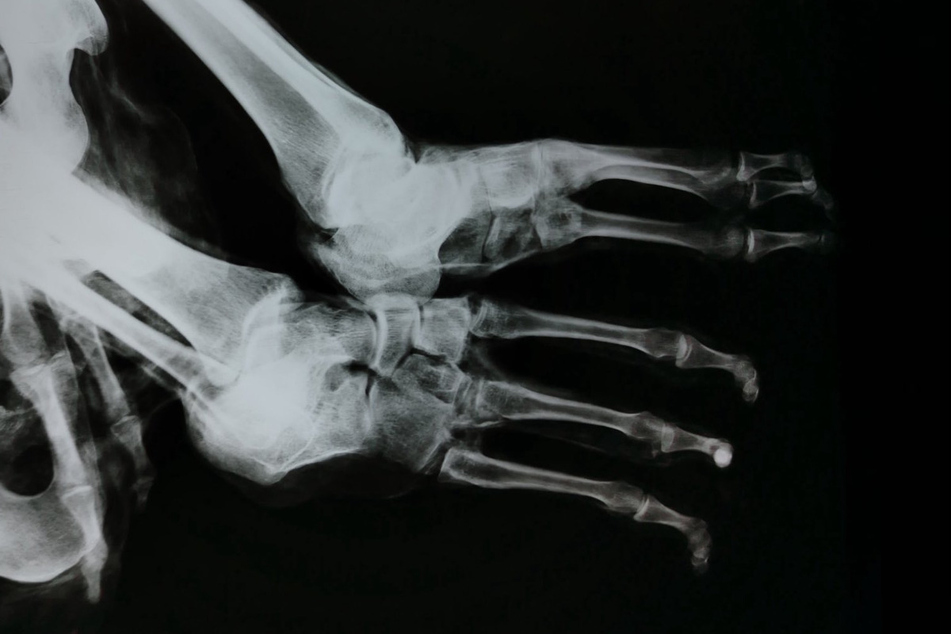 X-ray images should prove that they are real living beings.