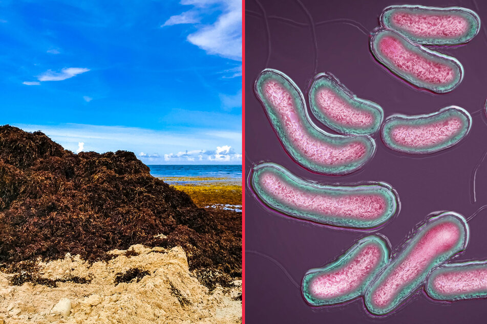 The 5,000-mile wide seaweed blob is bringing a new resident to Florida: flesh-eating bacteria.