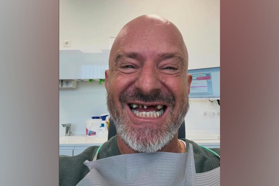 Detlef Steves (57) zeigt sich mit Zahnlücke nach dem Zahnarzt-Besuch auf Instagram.