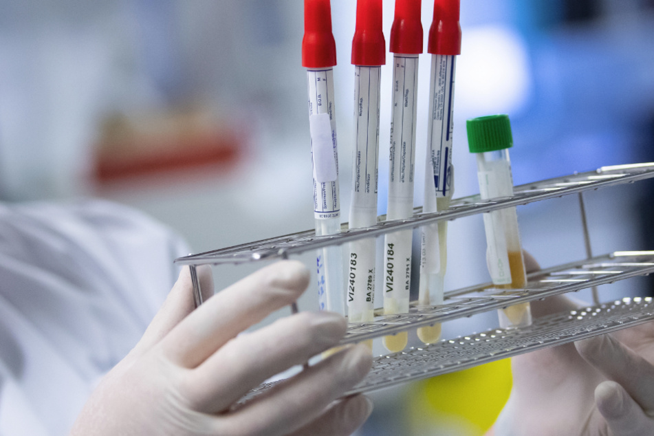 In Bayern sind nach neuesten Angaben bisher 48.189 Menschen positiv auf das Coronavirus getestet worden. (Symbolbild)