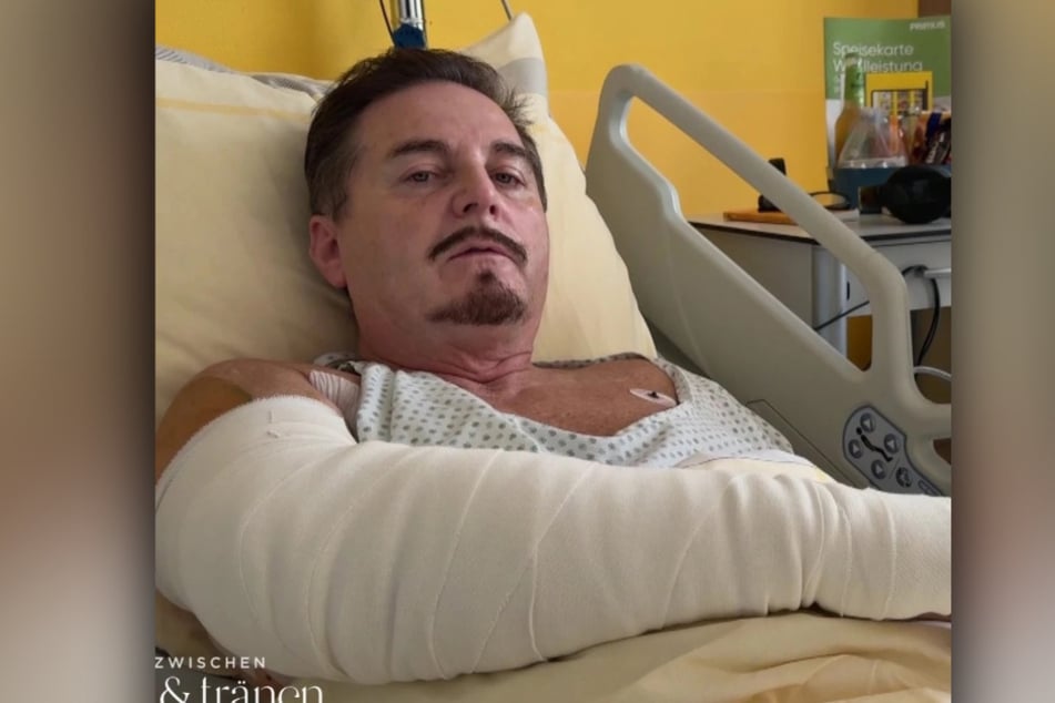 Am rechten Arm wucherte der aggressive Krebs. Uwe Herrmann überstand zwei OPs gut.