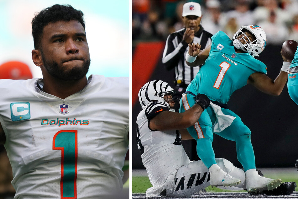 Dolphins QB Tua Tagovailoa sustained a head injury on September 29 after a sack from Bengals defensive tackle Josh Tupou.