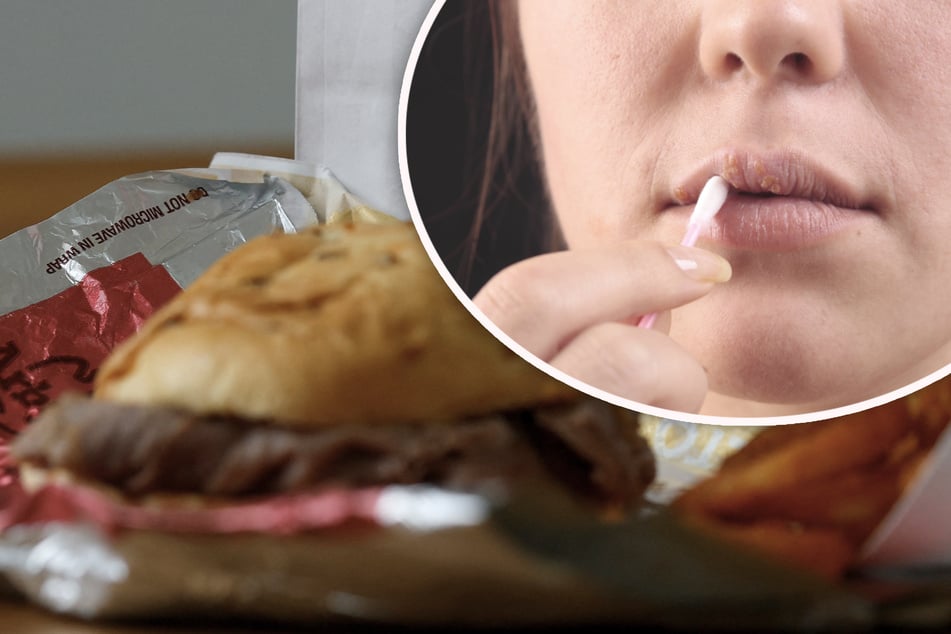 Ekel-Vorwurf gegen Fast-Food-Kette: Kundin behauptet, nach bespucktem Sandwich Herpes bekommen zu haben