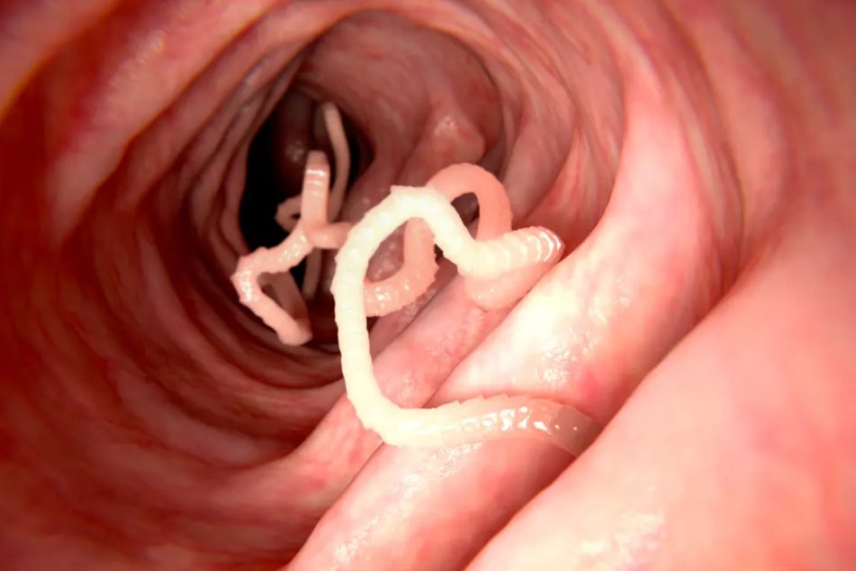 Tapeworms are dangerous parasites that infest the human intestine. If they are not treated, they lay eggs in the body and can cause irreparable brain damage. (symbolic image)