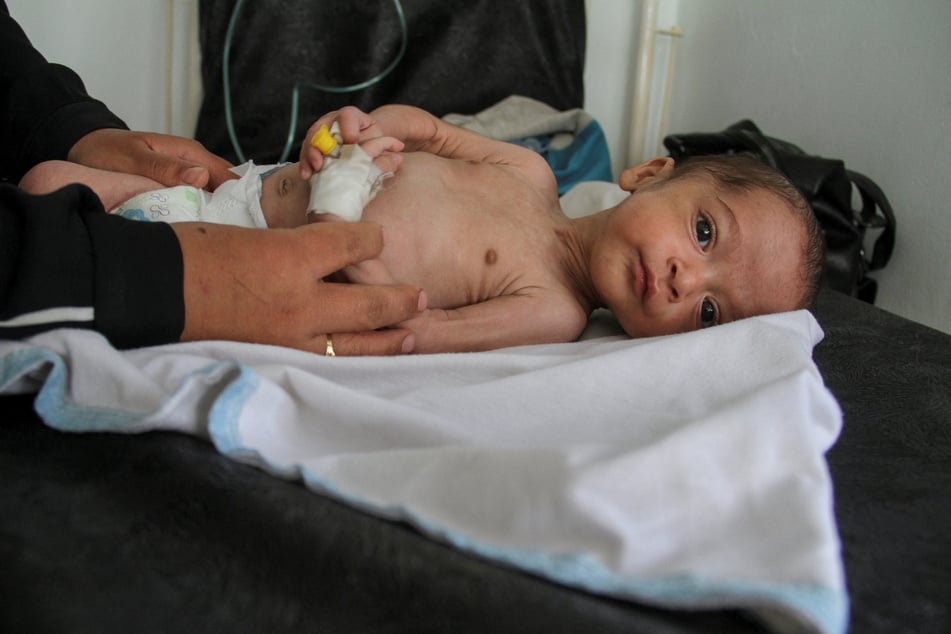 UN experts declare state of famine in all of Gaza and decry Israel's "genocidal violence"