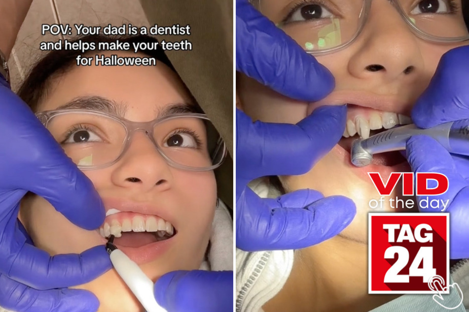 Today's Viral Video of the Day features a girl who's impressive dad, who's also a dentist, transformed her teeth into fangs for her vampire Halloween costume!