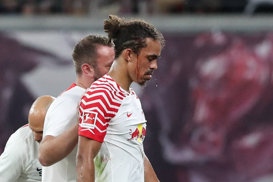 Kurz vor der Halbzeit musste RB Leipzigs Yussuf Poulsen (29) am Freitag behandelt werden. Durch die Kopfverletzung konnte er am Dienstag nur individuell trainieren.