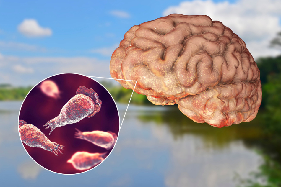 Naegleria fowleri ist ein seltener Parasit, der sich vom menschlichen Gehirn ernährt.