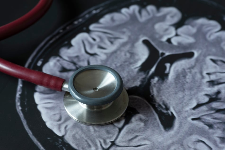 Alzheimer ist die häufigste Form der Demenz. (Symbolfoto)