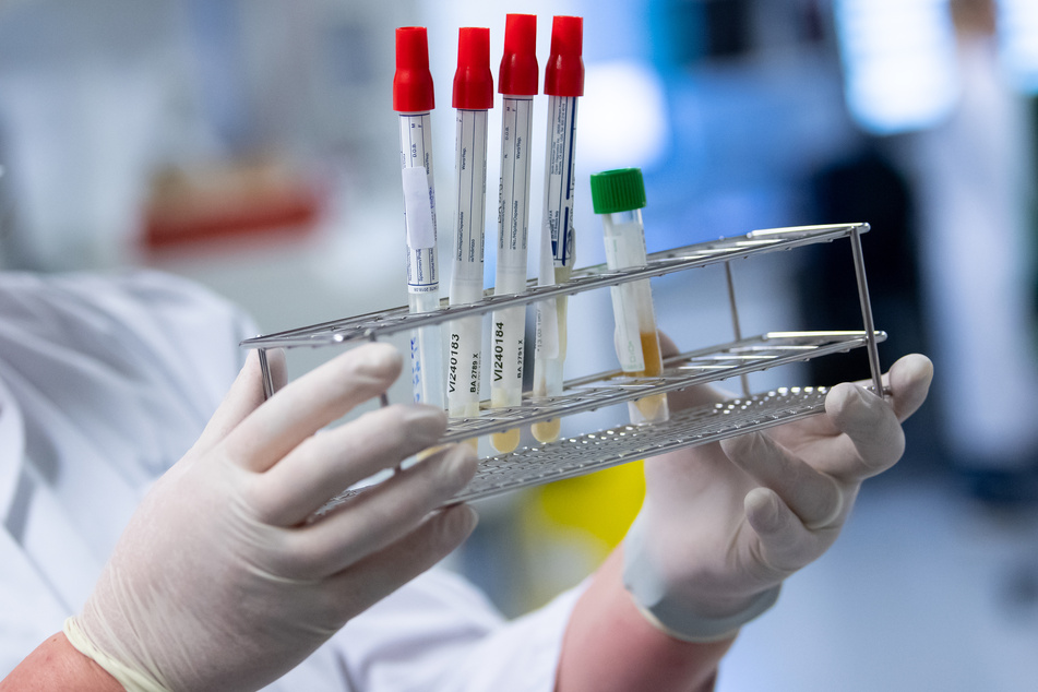 Eine Mitarbeiterin am Institut für Virologie der technischen Universität München (TUM) bereitet Proben von Menschen mit Covid-19 Verdacht in einem Labor für die weitere Analyse vor.