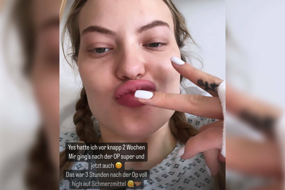 Cheyenne Ochsenknecht (21) hat ihrer Instagram-Community mit einem Foto aus dem Krankenhaus von ihrer Brust-OP berichtet.
