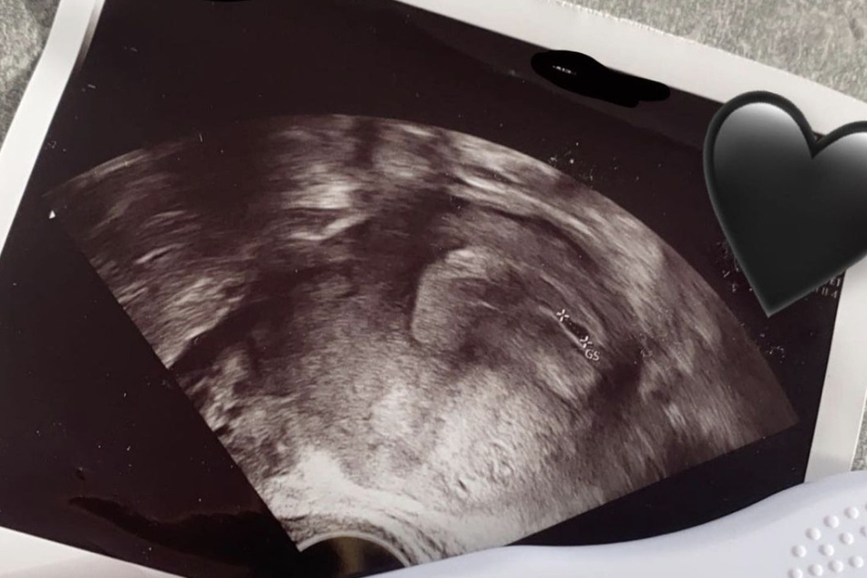 Zehn Monate nach der Geburt von Tochter Haylie ist Lavinia Wollny (23) erneut schwanger.