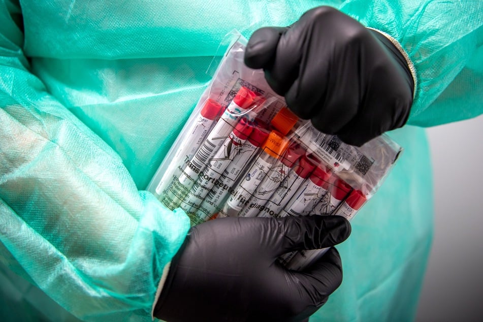 Proben für einen PCR-Test. Genesen gilt derjenige, welcher einen mindestens 28 Tage positiven und höchstens 6 Monate alten PCR-Test vorlegen kann.